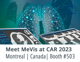 Meet MeVis Medical Solutions at CAR 2023 in Montreal, Canada.