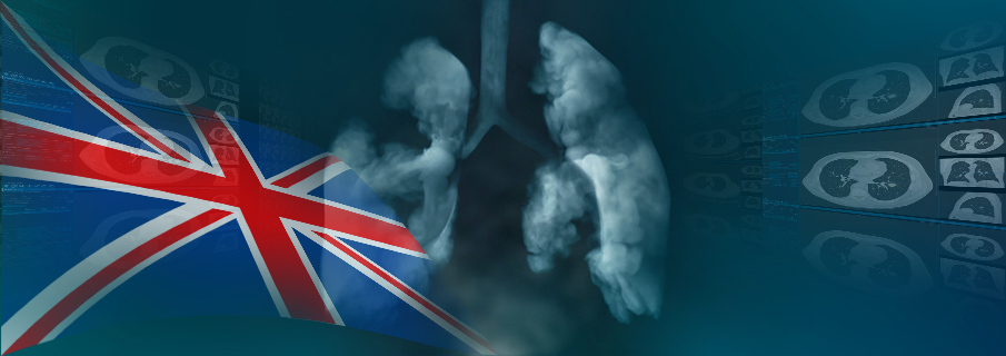 Lung Cancer Screening - United Kingdom